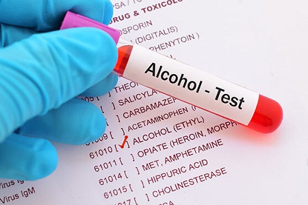 The Role Of A Toxicologist In Your DWI Case Is Important To Your DWI Legal Case